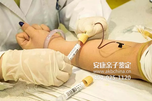 辽阳广州医院做亲子鉴定大概多少费用，广州医院需要多少费用亲子鉴定 
